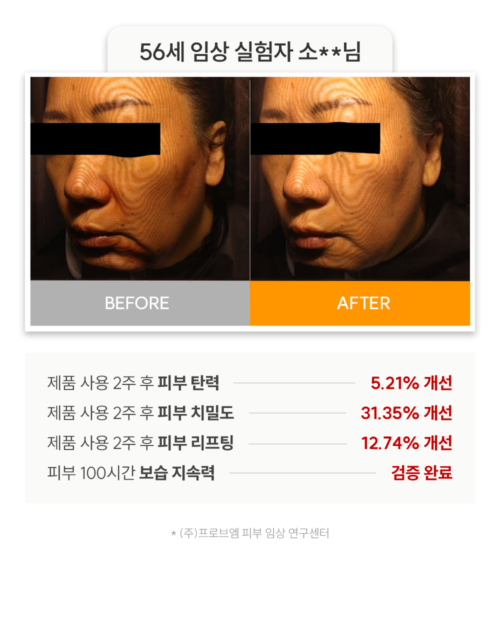 테스트2